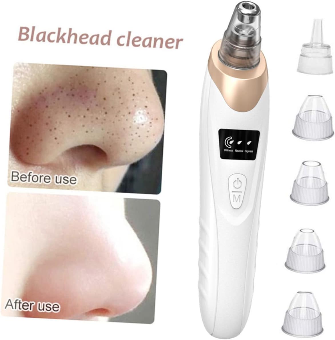 Electric Blackhead Remover - NextMamas