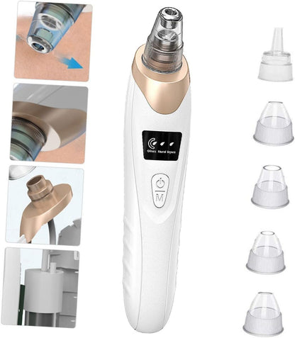 Electric Blackhead Remover - NextMamas