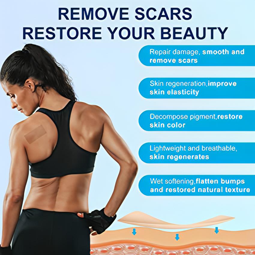 Scar Removal Silicone Gel Sheet | Fades C-Section Scars, Acne Scars, Wound &amp; Operation Scars - NextMamas