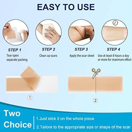 Scar Removal Silicone Gel Sheet | Fades C-Section Scars, Acne Scars, Wound &amp; Operation Scars - NextMamas