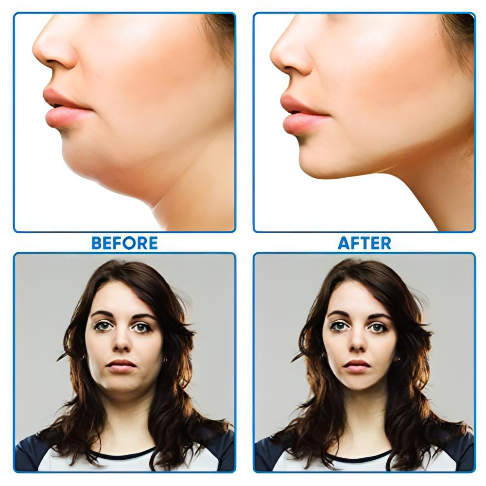 V Shaped Slimming Face Mask Double Chin Reducer | V line Lifting Mask Face Slimming. - NextMamas