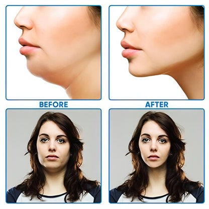 V Shaped Slimming Face Mask Double Chin Reducer | V line Lifting Mask Face Slimming. - NextMamas