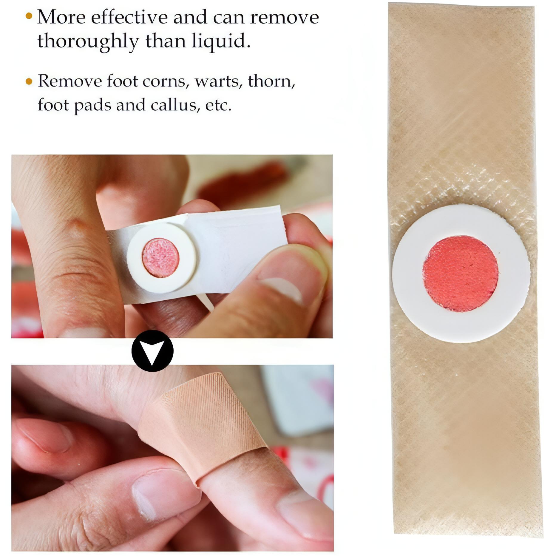 Foot Corn Pads – Remove Corns Quickly, Cushion Against Pressure - NextMamas