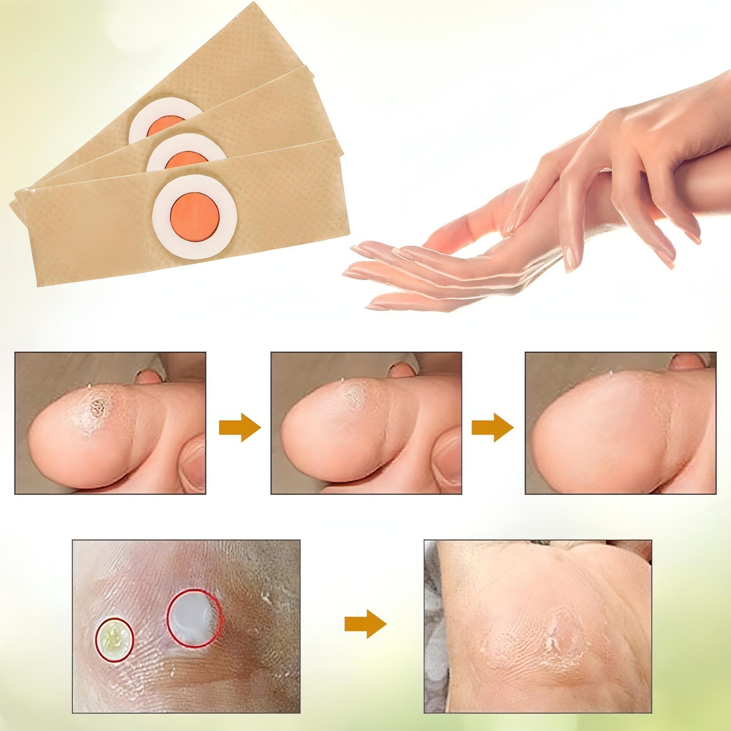 Foot Corn Pads – Remove Corns Quickly, Cushion Against Pressure - NextMamas