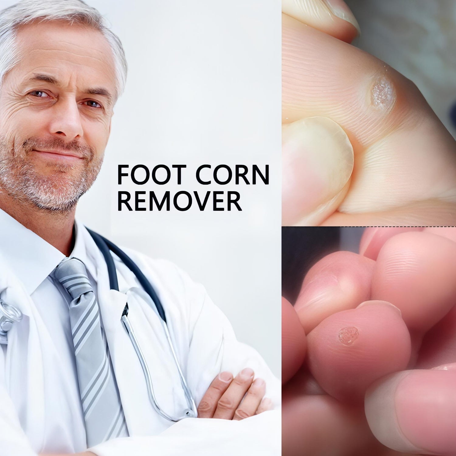 Foot Corn Pads – Remove Corns Quickly, Cushion Against Pressure - NextMamas