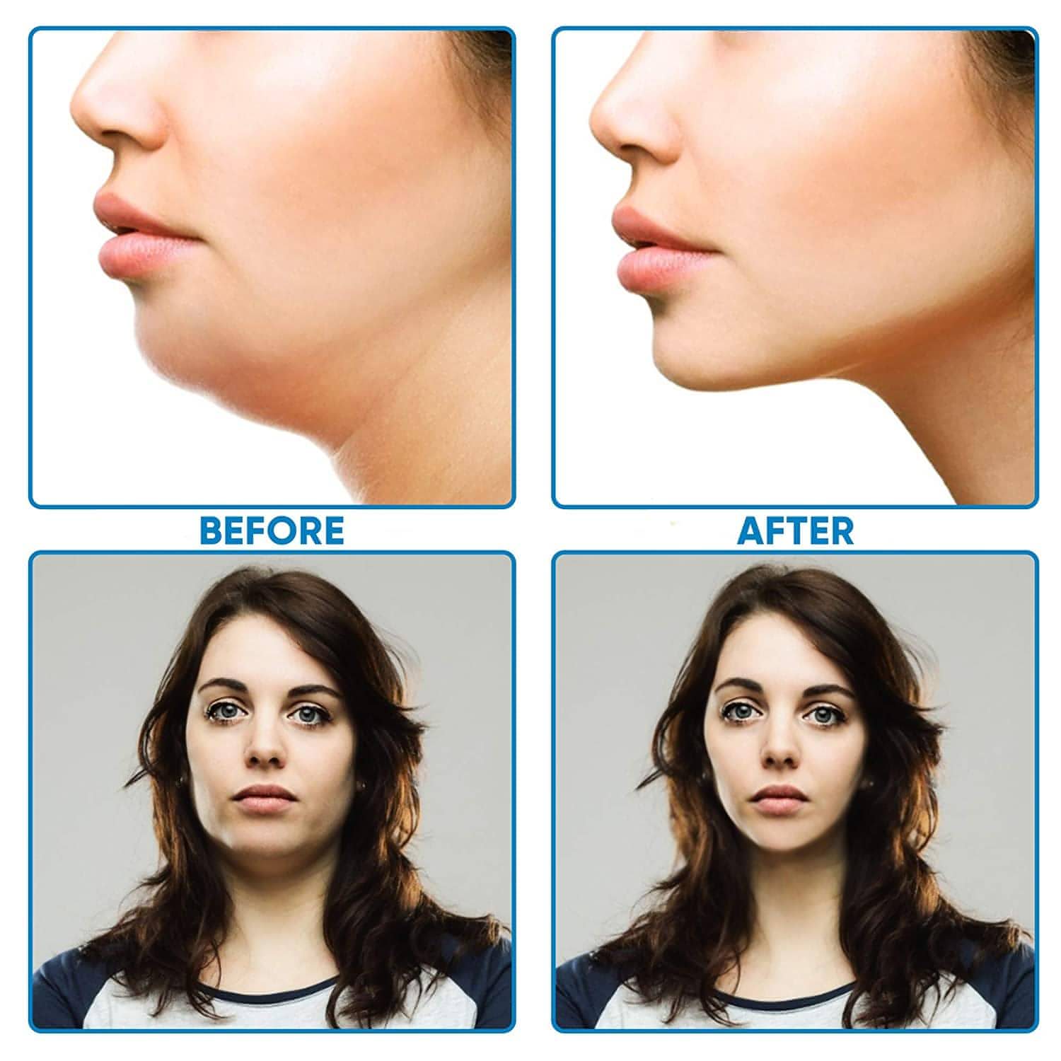 Double Chin Reducer – Reusable V-Line Lifting Mask