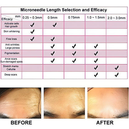 Premium Gold Titanium Micro Needles Derma Roller | For Face Lift, Stretch Marks, Glowing Skin &amp; Scar Treatment - NextMamas