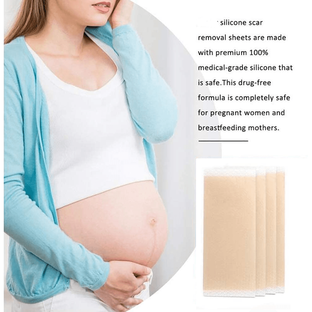 Scar Removal Silicone Gel Sheet | Fades C-Section Scars, Acne Scars, Wound &amp; Operation Scars - NextMamas