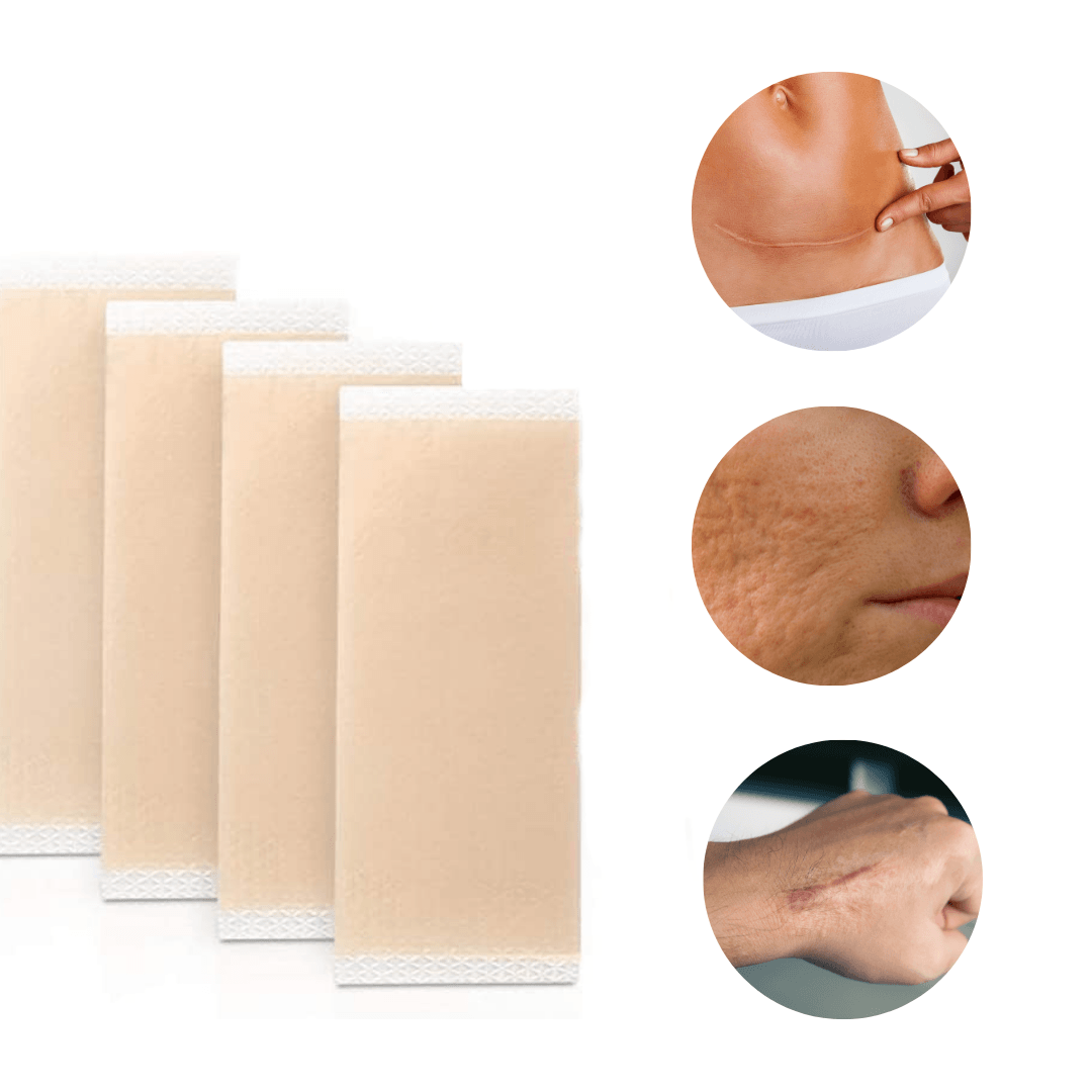 Scar Removal Silicone Gel Sheet | Fades C-Section Scars, Acne Scars, Wound &amp; Operation Scars - NextMamas